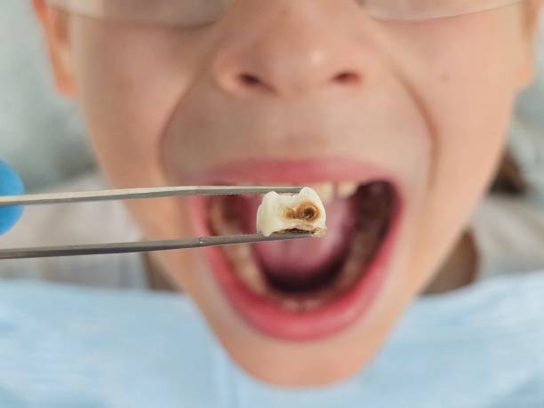 Best Broken or Cracked Tooth Emergency Dentist in Bryant, AR